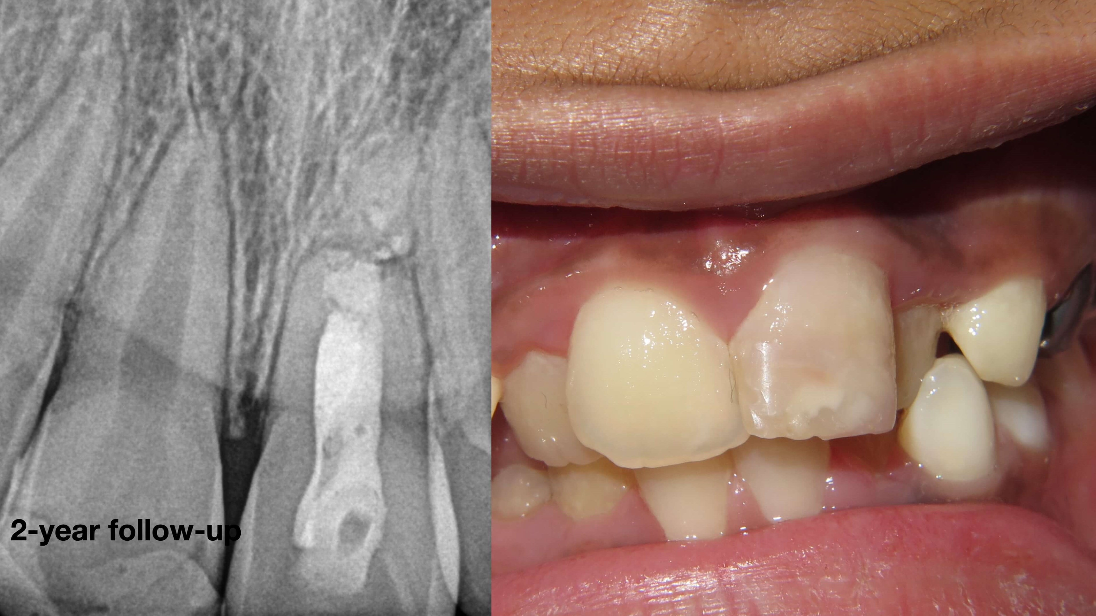 Case 1